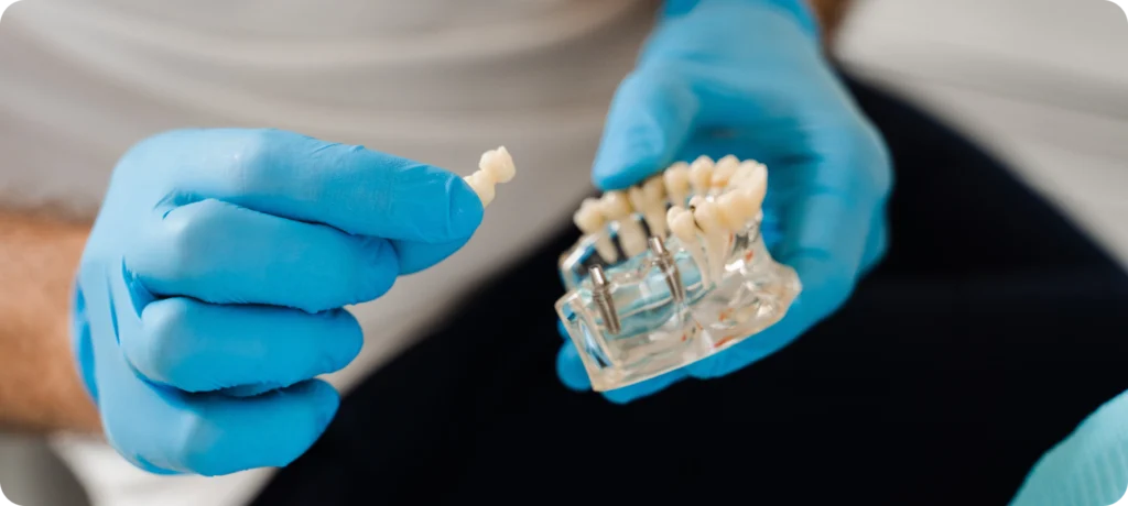 consultation dentiste digne les bains implant dentaire Dentiste à Digne-les-Bains Dentistes à Château-Arnoux-Saint-Auban