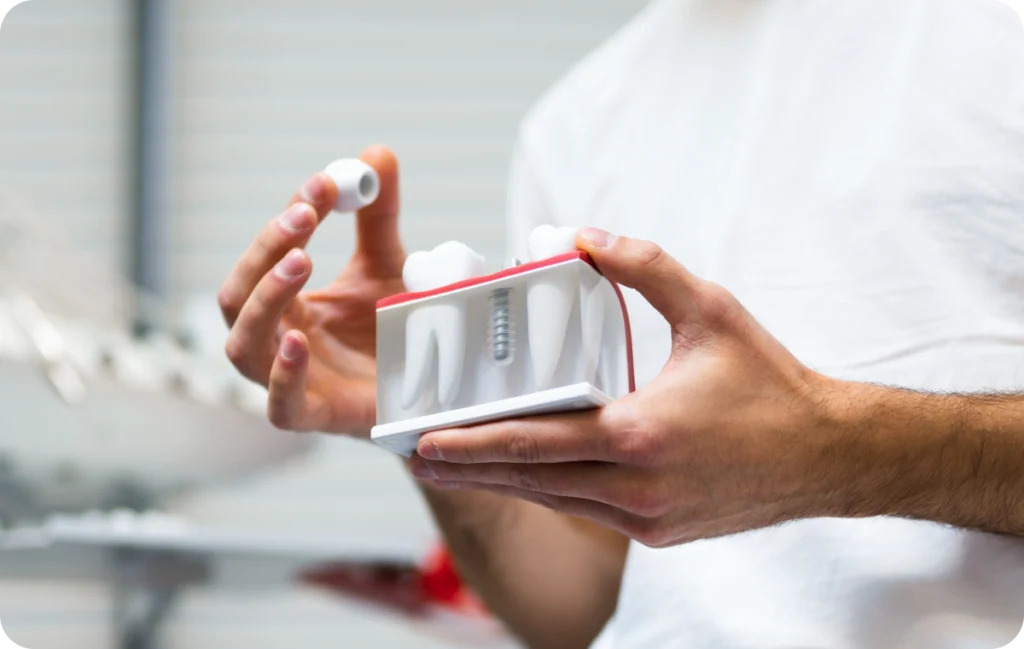 consultation dentiste barcelonnette implant dentaire Dentiste à Barcelonnette Dentistes à Château-Arnoux-Saint-Auban