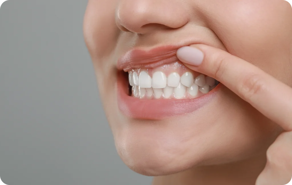 consultation dentiste sisteron parodontite Dentiste à Sisteron Dentistes à Château-Arnoux-Saint-Auban