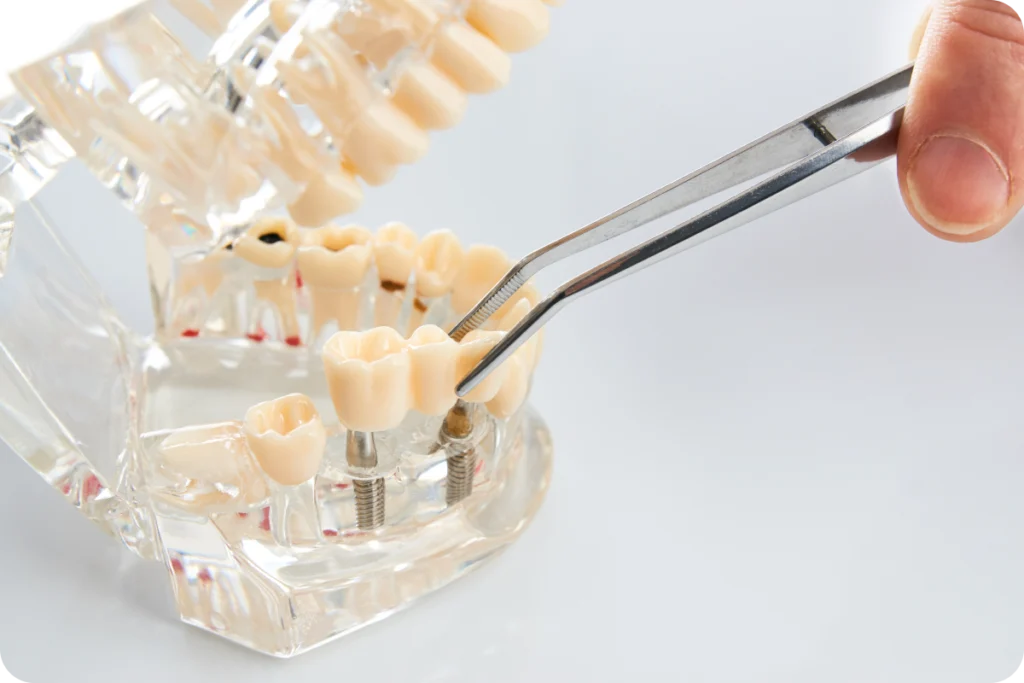 consultation dentiste vinon sur verdon Dentiste à Vinon-sur-Verdon Dentistes à Château-Arnoux-Saint-Auban