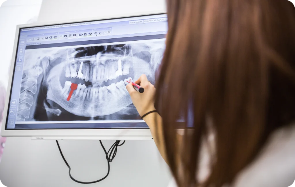 dentiste gap implant dentaire Dentiste à Gap Dentistes à Château-Arnoux-Saint-Auban